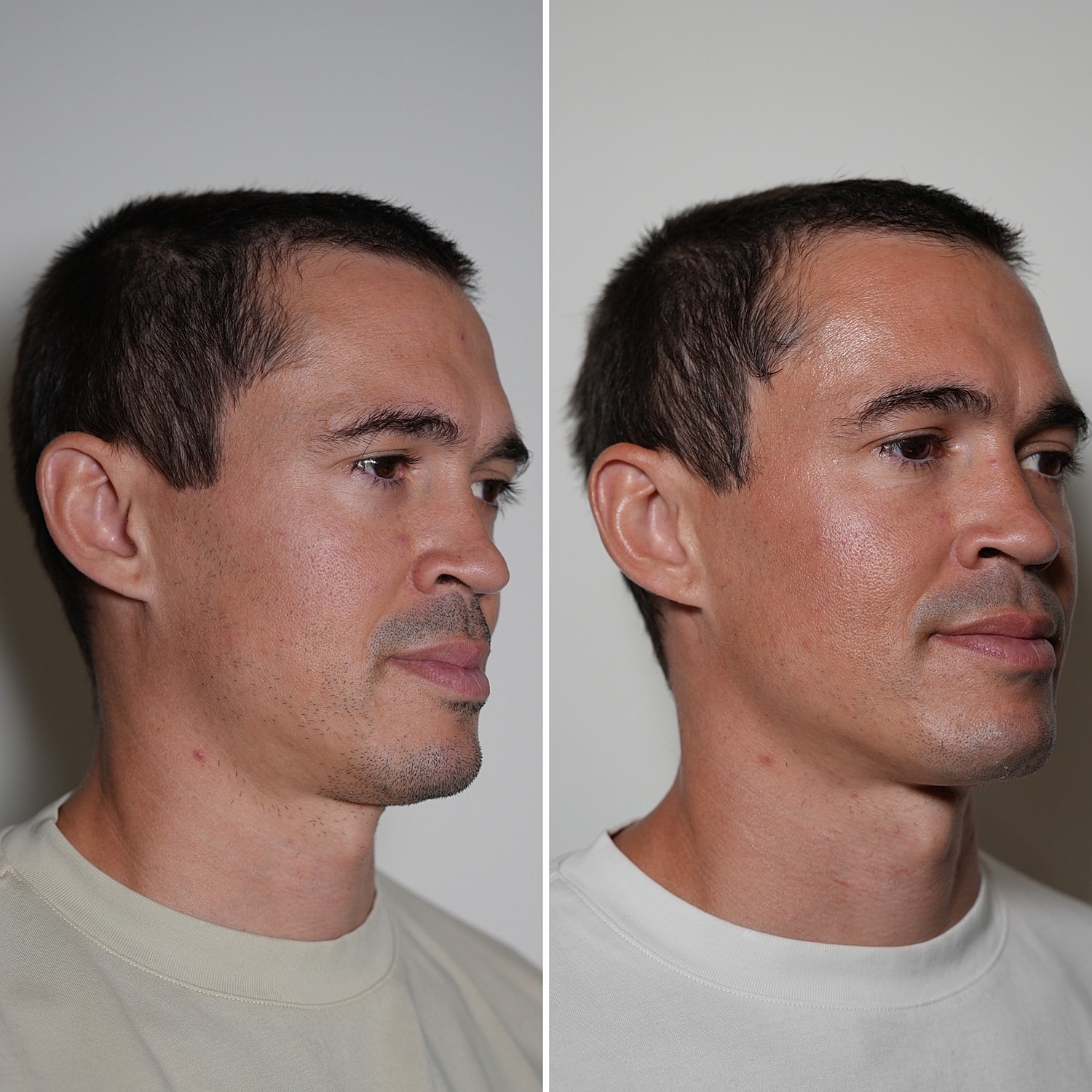 Laser Services Before & After