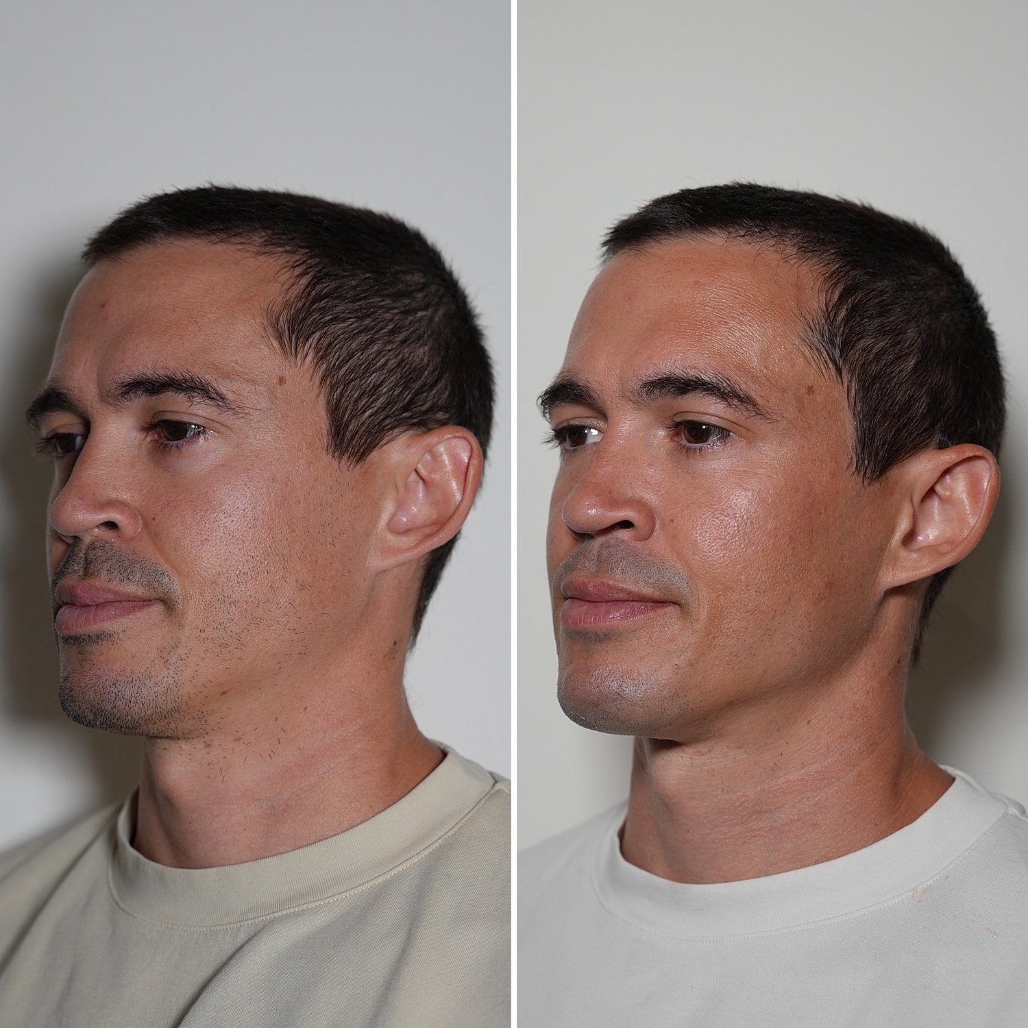 Laser Services Before & After