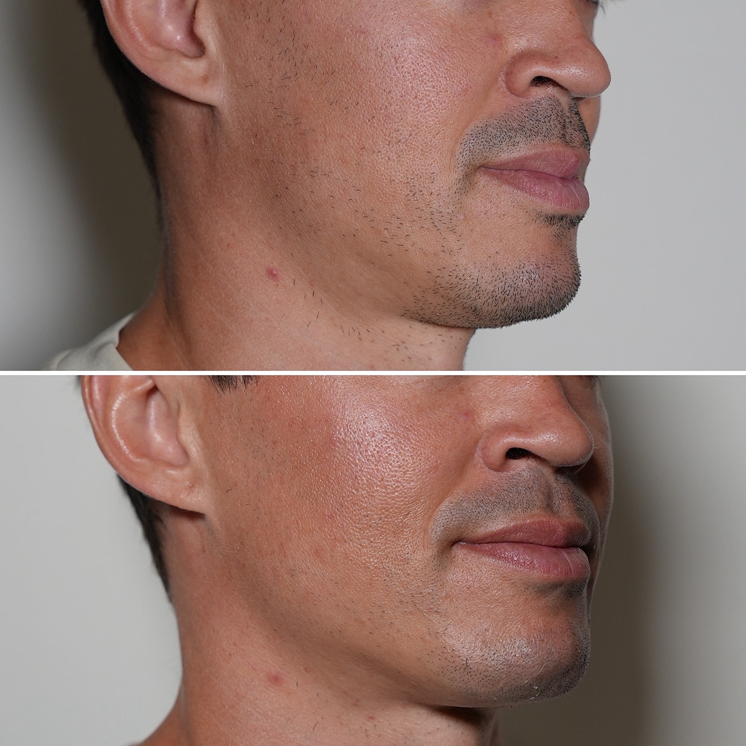 Laser Services Before & After